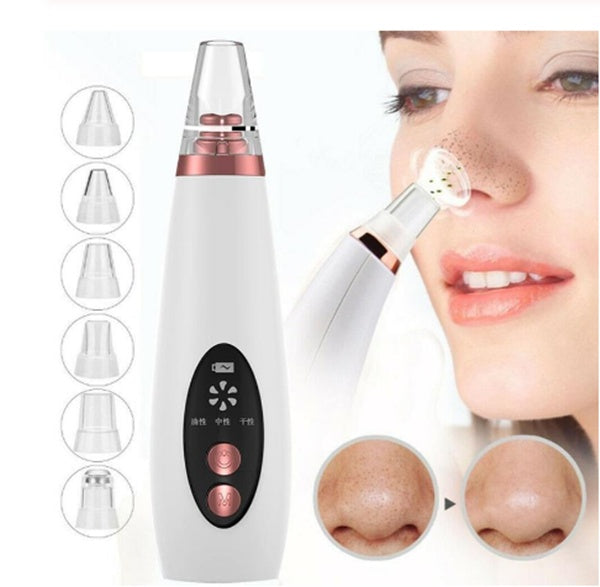 Best Blackhead Remover Vacuum for Nose – Electric Pore Cleaner with 6 Suction Heads, USB Rechargeable - Deep Pore Cleansing - Portable Blackhead Remover for women